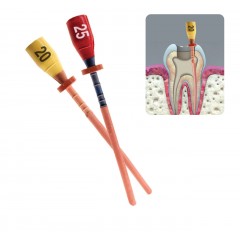 Pacdent One HT Reciprocal File™ Gutta Percha Core Carrier Obturators - 5 x Primary #25 (Red) Obturators + 1 x verifier
